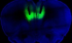 Optogenetic stimulation using laser pulses lights up the prelimbic cortex.