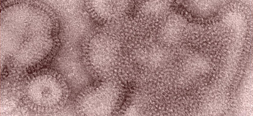 The flu virus under a powerful microscope.