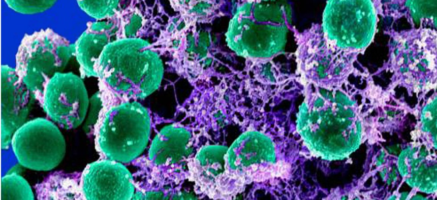 A 2011 digitally-colorized electron microscope image made available by the National Institute of Allergy and Infectious Diseases shows a clump of green-colored, spheroid-shaped, Staphylococcus epidermidis bacteria on a purple-colored matrix.