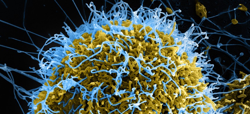 Colorized scanning electron micrograph of filamentous Ebola virus particles (blue) budding from an infected cell (yellow-green).
