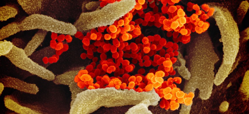  This scanning electron microscope image shows SARS-CoV-2 (orange)—also known as 2019-nCoV, the virus that causes COVID-19—isolated from a patient in the U.S., emerging from the surface of cells (green) cultured in the lab. 