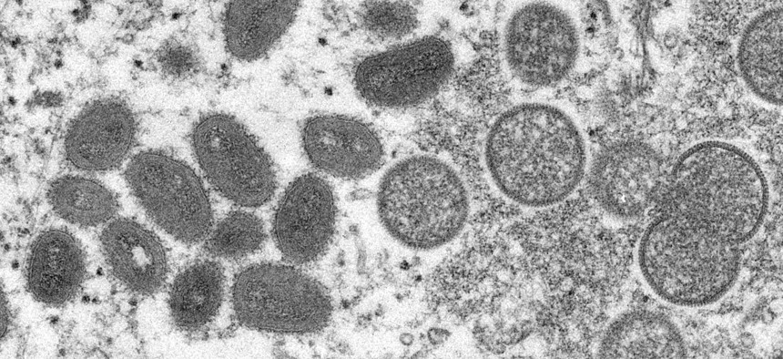 Electron microscope image of various virions (virus particles) of the monkeypox virus taken from human skin in 2003.