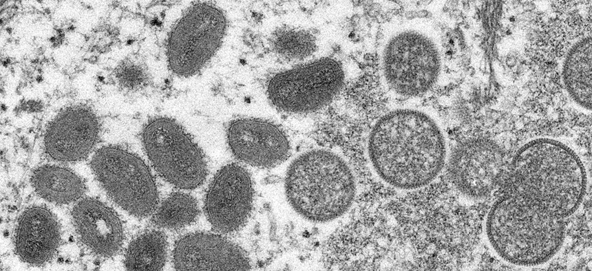 Monkeypox is caused by the monkeypox virus, which are the ovals and circles seen in this electron microscope image of the skin of a person infected with monkeypox.